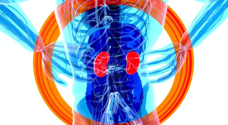 pedras nos rins e infertilidade