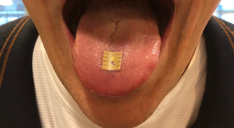 lsd